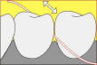 DOEN�A PERIODONTAL